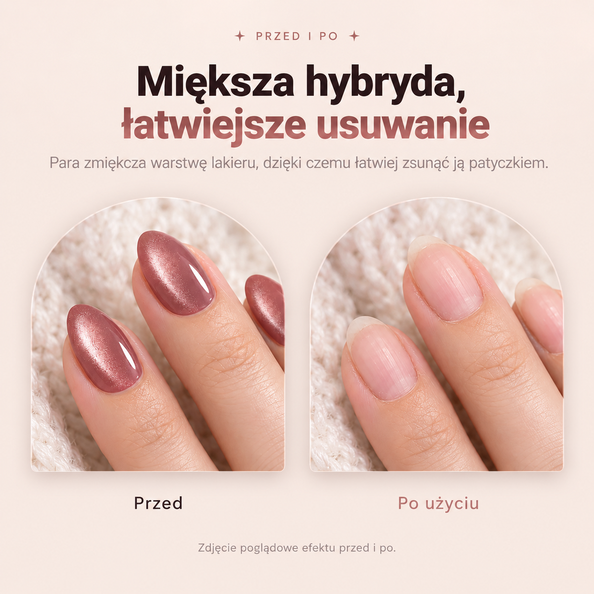 Parowe urządzenie do usuwania hybrydy